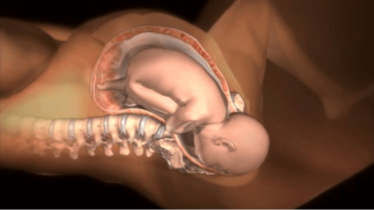 recreación nacimiento bebé