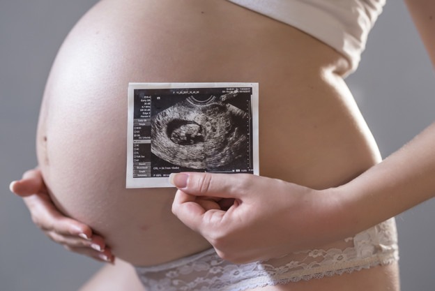 mujer embarazada con ecografía