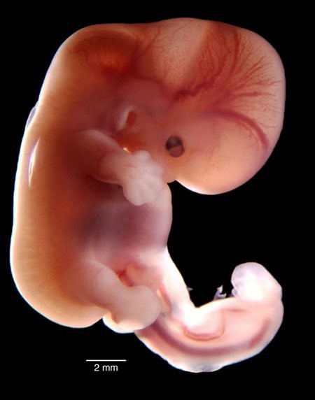9 meses de embarazo a través de espectaculares imágenes - Ecografia 4D y  Medicina Fetal Centro Gutenberg